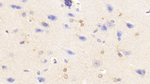 TNF alpha Antibody in Immunohistochemistry (Paraffin) (IHC (P))