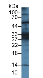 KRT28 Polyclonal Antibody