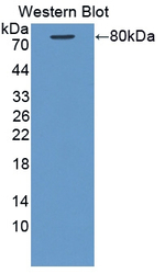 KRT28 Antibody in Western Blot (WB)