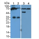 Human IgM Antibody in Western Blot (WB)
