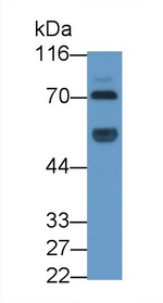 Human IgM Antibody in Western Blot (WB)