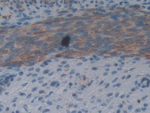 IL1F5 Antibody in Immunohistochemistry (Paraffin) (IHC (P))