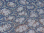IL1F5 Polyclonal Antibody