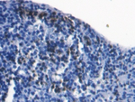 S100A8 Polyclonal Antibody