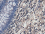 PLP2 Polyclonal Antibody