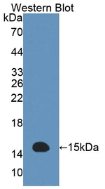 ACYP2 Polyclonal Antibody