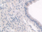 HPS1 Polyclonal Antibody