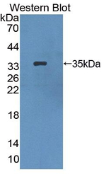 HPS1 Antibody in Western Blot (WB)