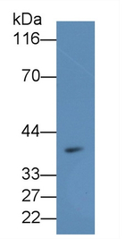MTNR1A Antibody in Western Blot (WB)
