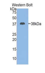 Cystatin A Antibody in Western Blot (WB)