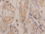 gamma Actin Antibody in Immunohistochemistry (Paraffin) (IHC (P))