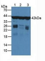gamma Actin Antibody in Western Blot (WB)