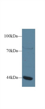 GTF3A Antibody in Western Blot (WB)