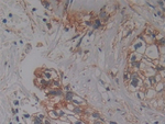 PKC iota Antibody in Immunohistochemistry (Paraffin) (IHC (P))