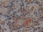 PKC iota Antibody in Immunohistochemistry (Paraffin) (IHC (P))