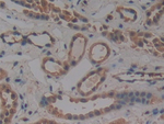 PKC iota Antibody in Immunohistochemistry (Paraffin) (IHC (P))