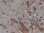 PKC iota Antibody in Immunohistochemistry (Paraffin) (IHC (P))