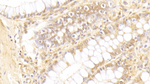 PGM5 Antibody in Immunohistochemistry (Paraffin) (IHC (P))