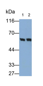 PGM5 Antibody in Western Blot (WB)