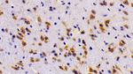 ABCA8 Polyclonal Antibody