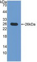 CD275 (B7-H2) Antibody in Western Blot (WB)