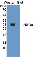 CRYGF Polyclonal Antibody