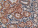 HFE2 Polyclonal Antibody