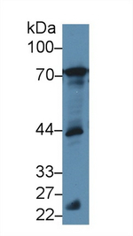 BLNK Antibody in Western Blot (WB)