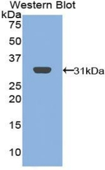 BLNK Antibody in Western Blot (WB)