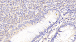 NKG2C Polyclonal Antibody