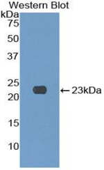 NKG2C Antibody in Western Blot (WB)