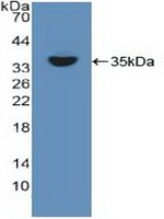 RelB Antibody in Western Blot (WB)
