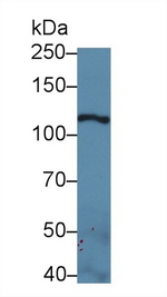 Laminin gamma-2 Antibody in Western Blot (WB)