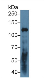 Laminin gamma-2 Antibody in Western Blot (WB)