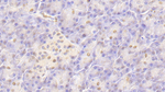 HIST2H2BE Polyclonal Antibody