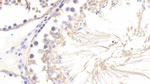WFDC5 Antibody in Immunohistochemistry (Paraffin) (IHC (P))