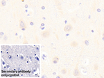 mGluR3 Antibody in Immunohistochemistry (Paraffin) (IHC (P))