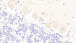mGluR3 Antibody in Immunohistochemistry (Paraffin) (IHC (P))