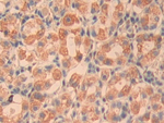 CYR61 Antibody in Immunohistochemistry (Paraffin) (IHC (P))