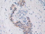 CYR61 Antibody in Immunohistochemistry (Paraffin) (IHC (P))