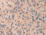 CYR61 Antibody in Immunohistochemistry (Paraffin) (IHC (P))
