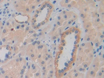 CYR61 Antibody in Immunohistochemistry (Paraffin) (IHC (P))