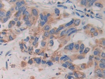 CYR61 Antibody in Immunohistochemistry (Paraffin) (IHC (P))