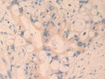 CYR61 Polyclonal Antibody