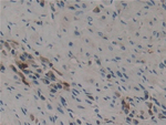 Midkine Antibody in Immunohistochemistry (Paraffin) (IHC (P))