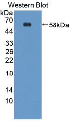 TMEFF1 Antibody in Western Blot (WB)