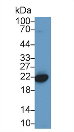 HP1 gamma Antibody in Western Blot (WB)
