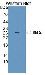 MCM2 Antibody in Western Blot (WB)