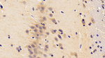 NT5M Antibody in Immunohistochemistry (Paraffin) (IHC (P))
