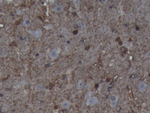 S100B Antibody in Immunohistochemistry (Paraffin) (IHC (P))